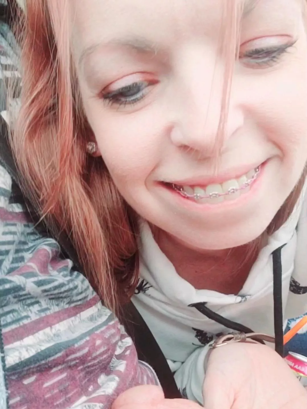 Blue Eyes, Braces, and Blowjobs posted by xKadyLadyx