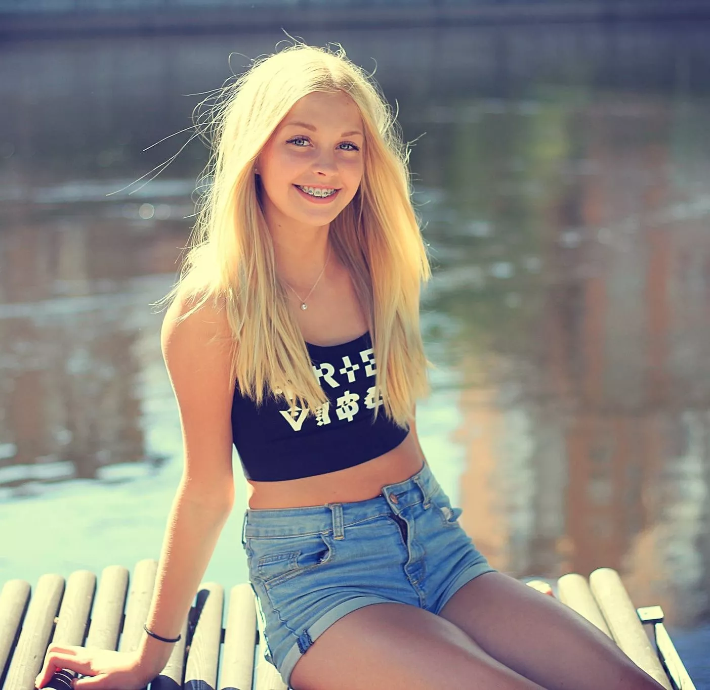 Braces posted by LayDownYourBurdens