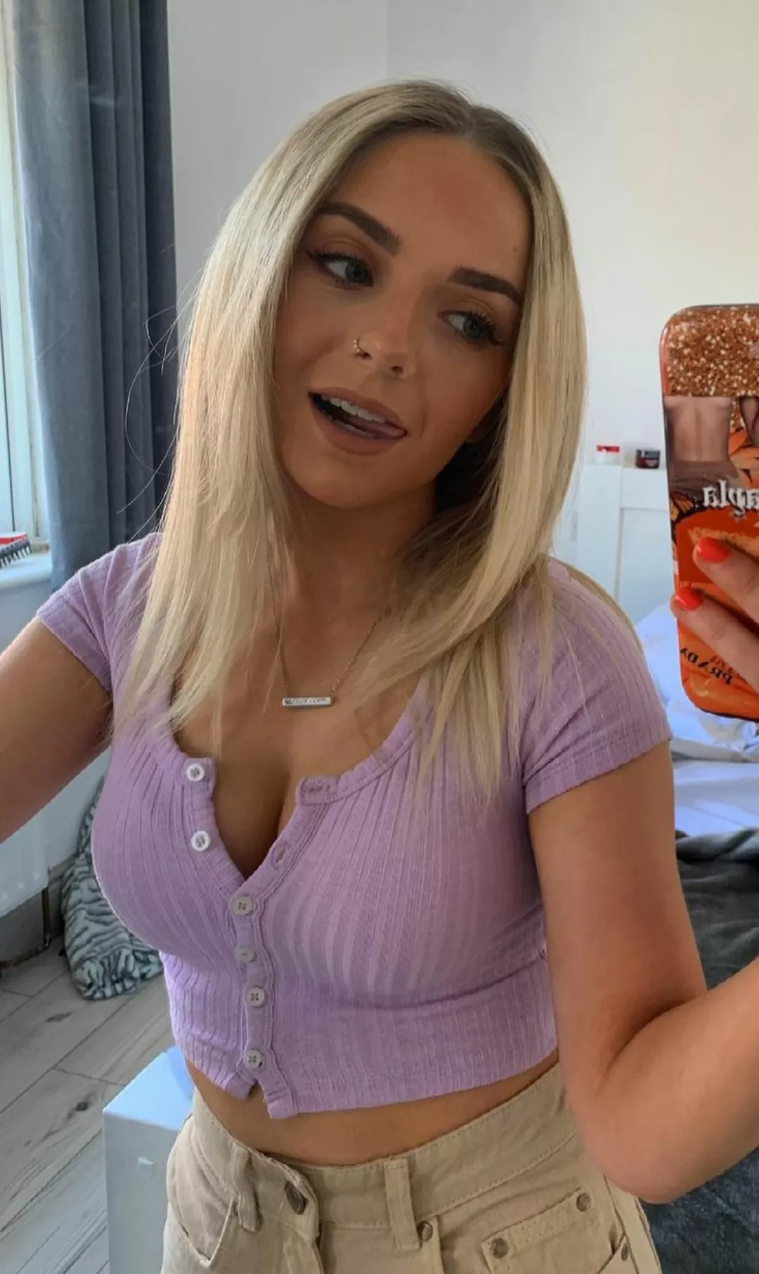 Braces posted by Due_Donut_8032