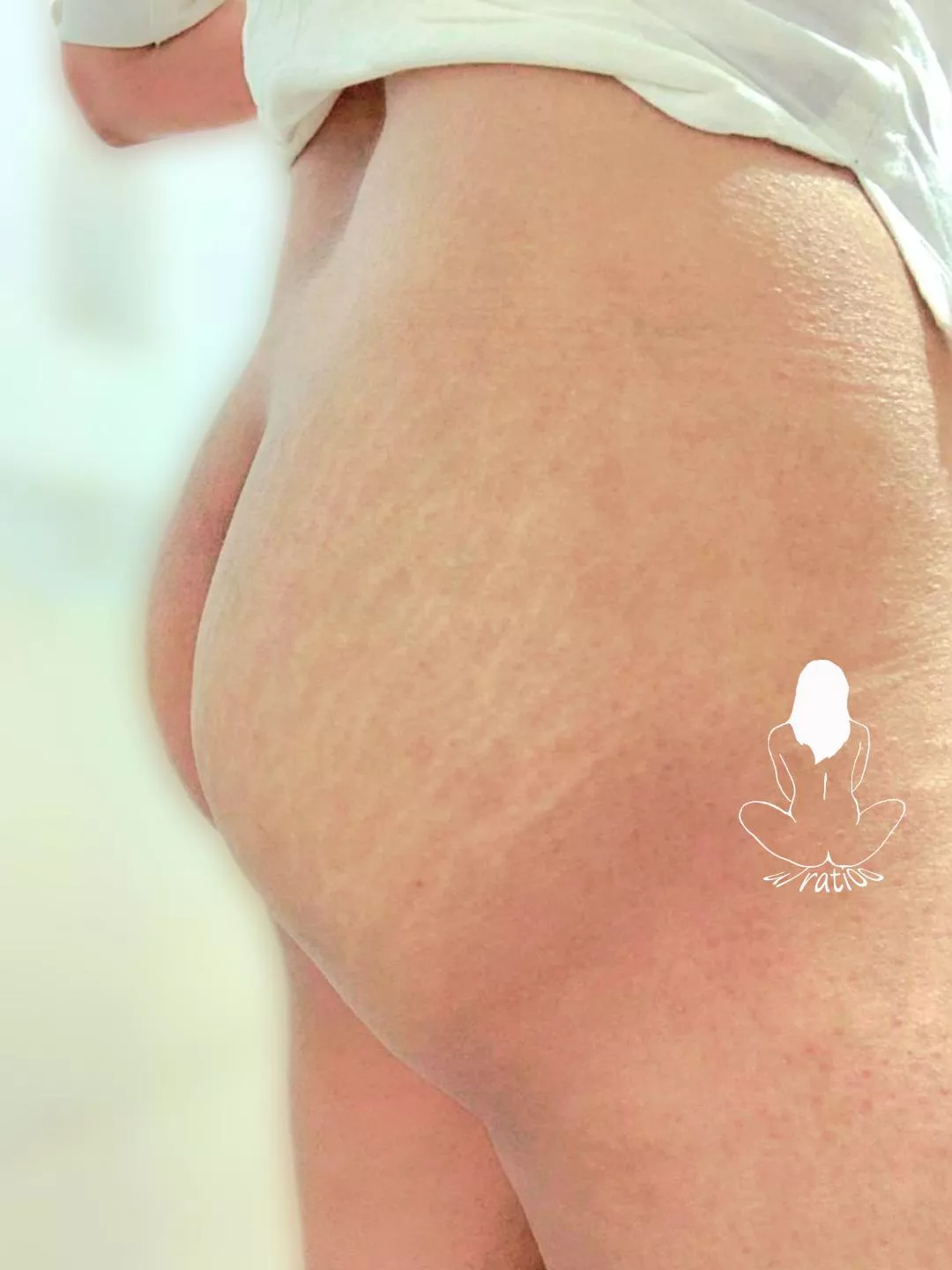 Bum Flash [f]! posted by Rati00