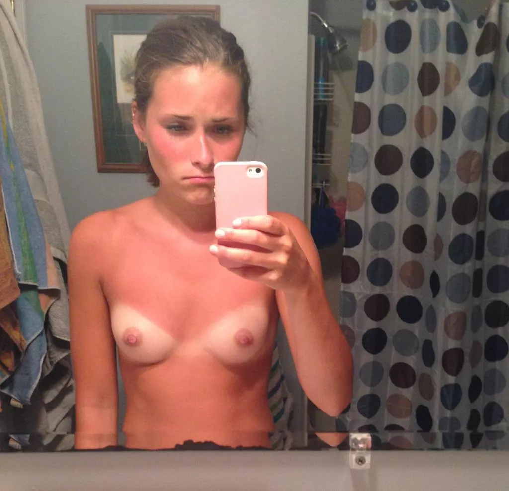 Burnt her tiny titties posted by kinkykat977