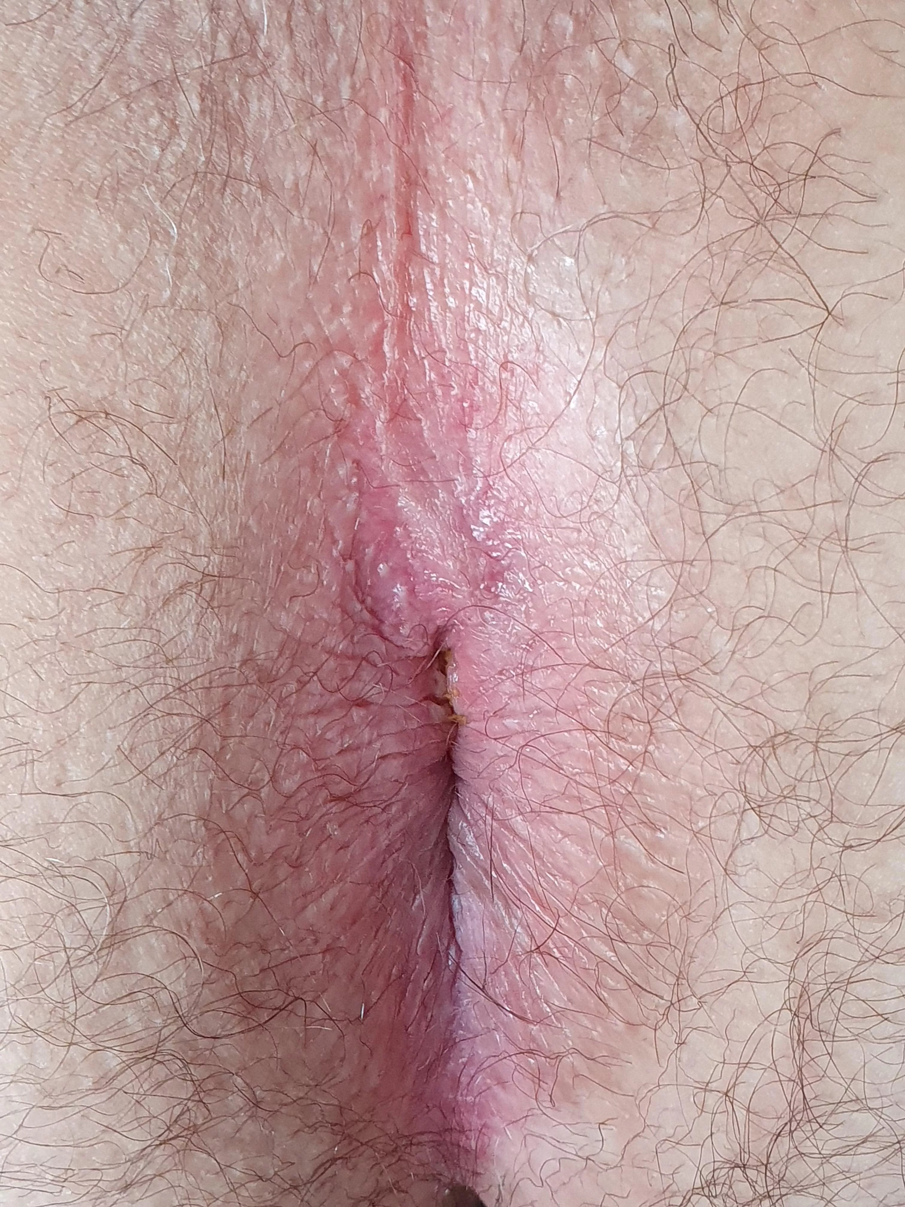 bury your tongue as deep as you can. posted by Responsible-Water924