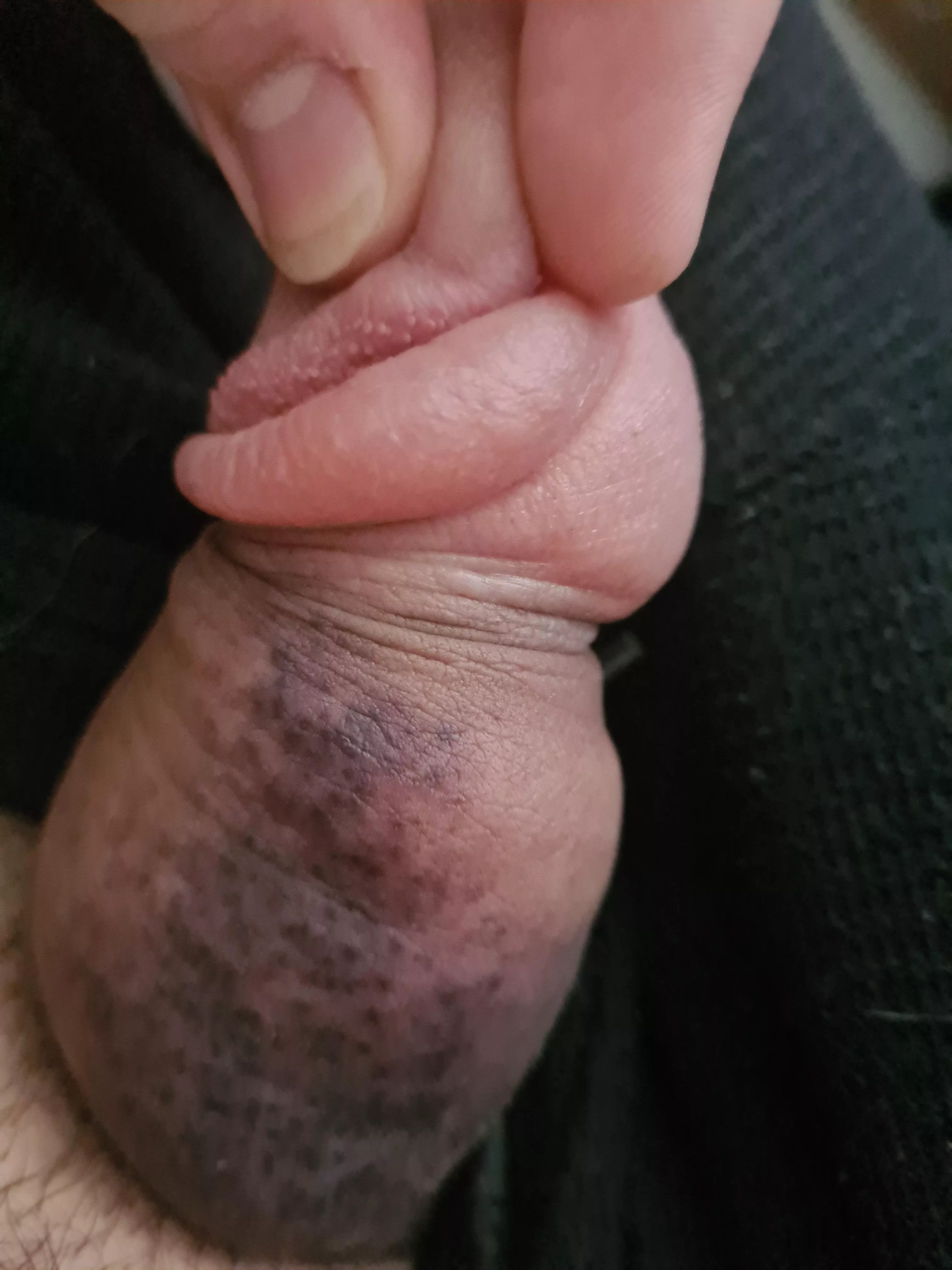 can someone explain why after pumping this area never gets larger? posted by No_Afternoon_4506