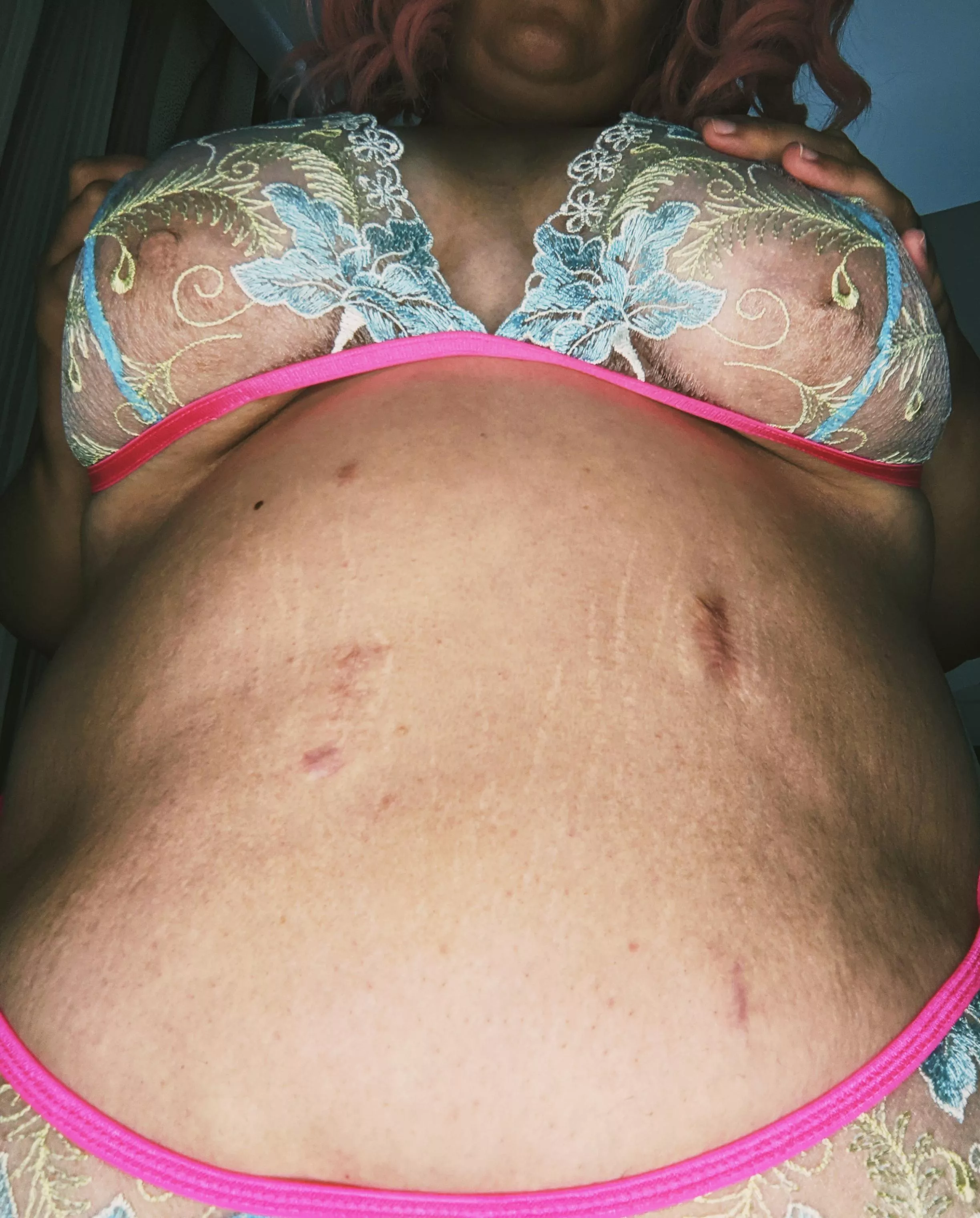 Can you take this off posted by Fatty-Cake