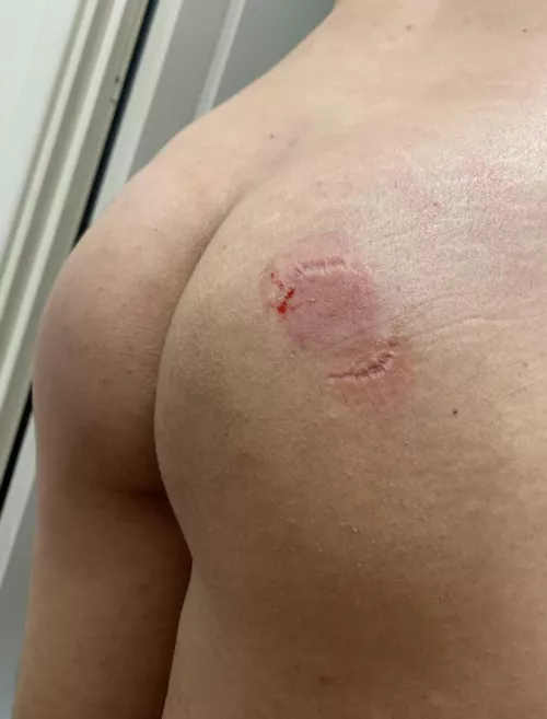 *chomp* [NB] by peachwitchprivate