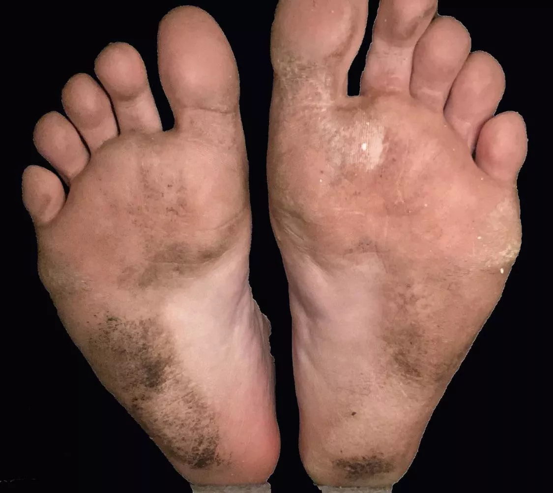 clean my filthy soles with your tongue posted by duskstation