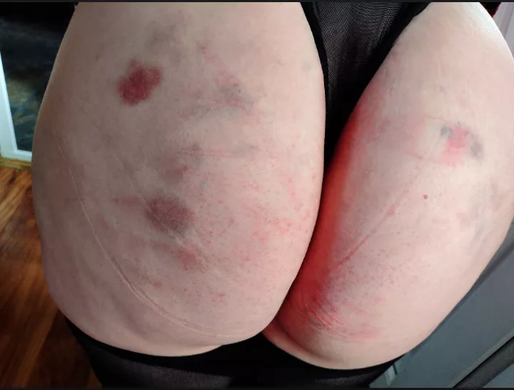 Consequences for a Brat😈 posted by PlagueofMetal97