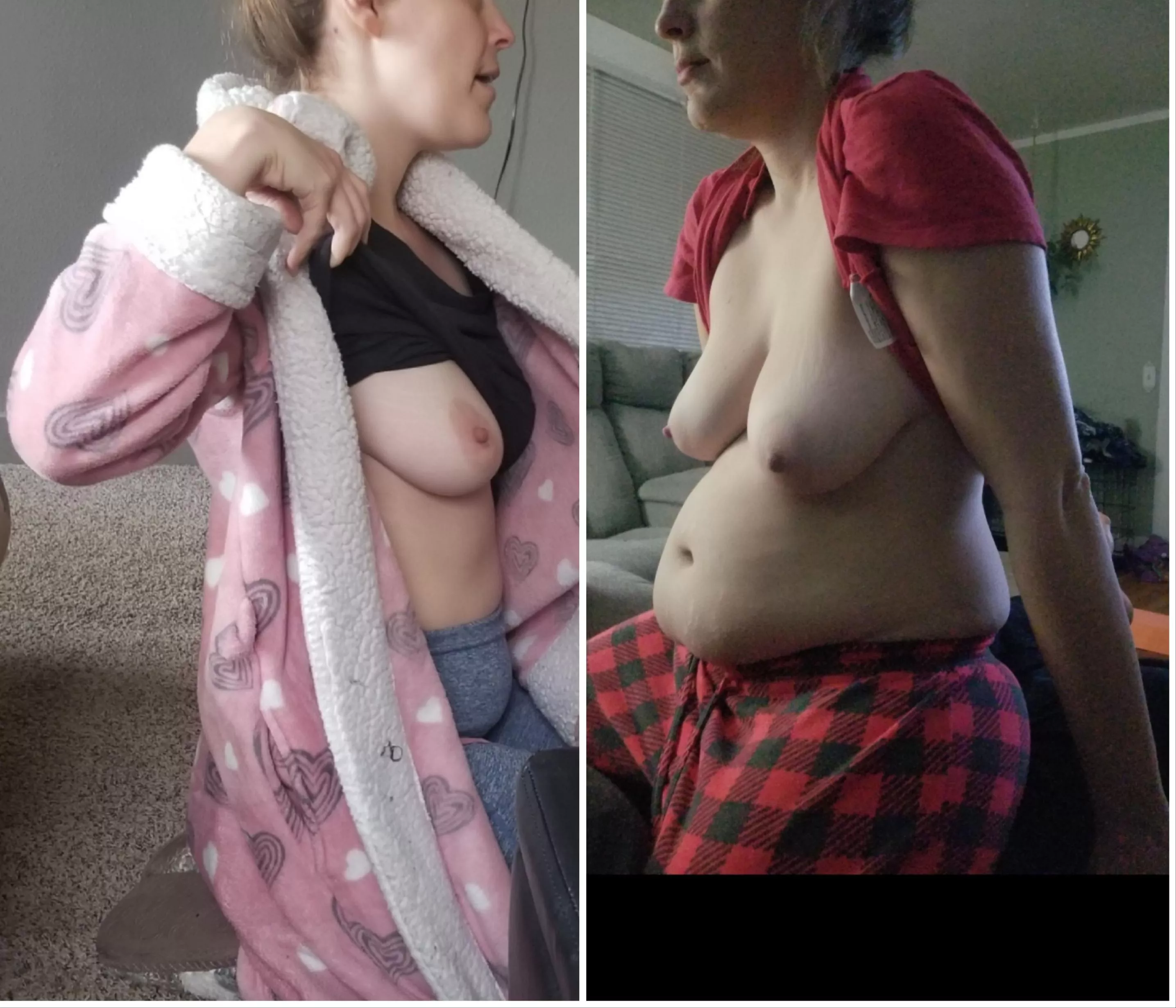 Couple years ago to now....! posted by SnooCompliments7968