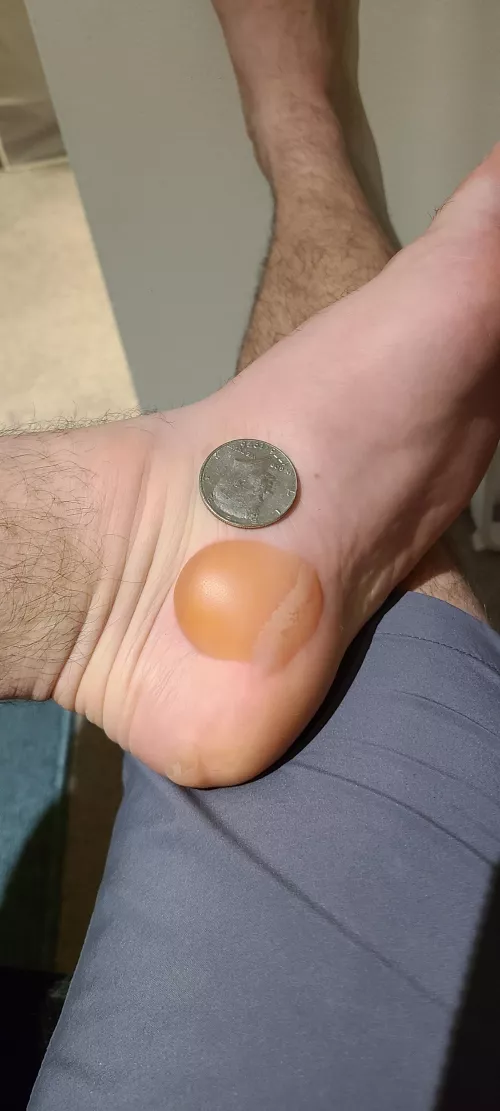 Courtesy of the Boston Marathon by CoolMAF