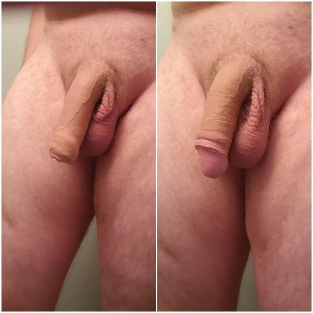 covered or pulled back? posted by devr720