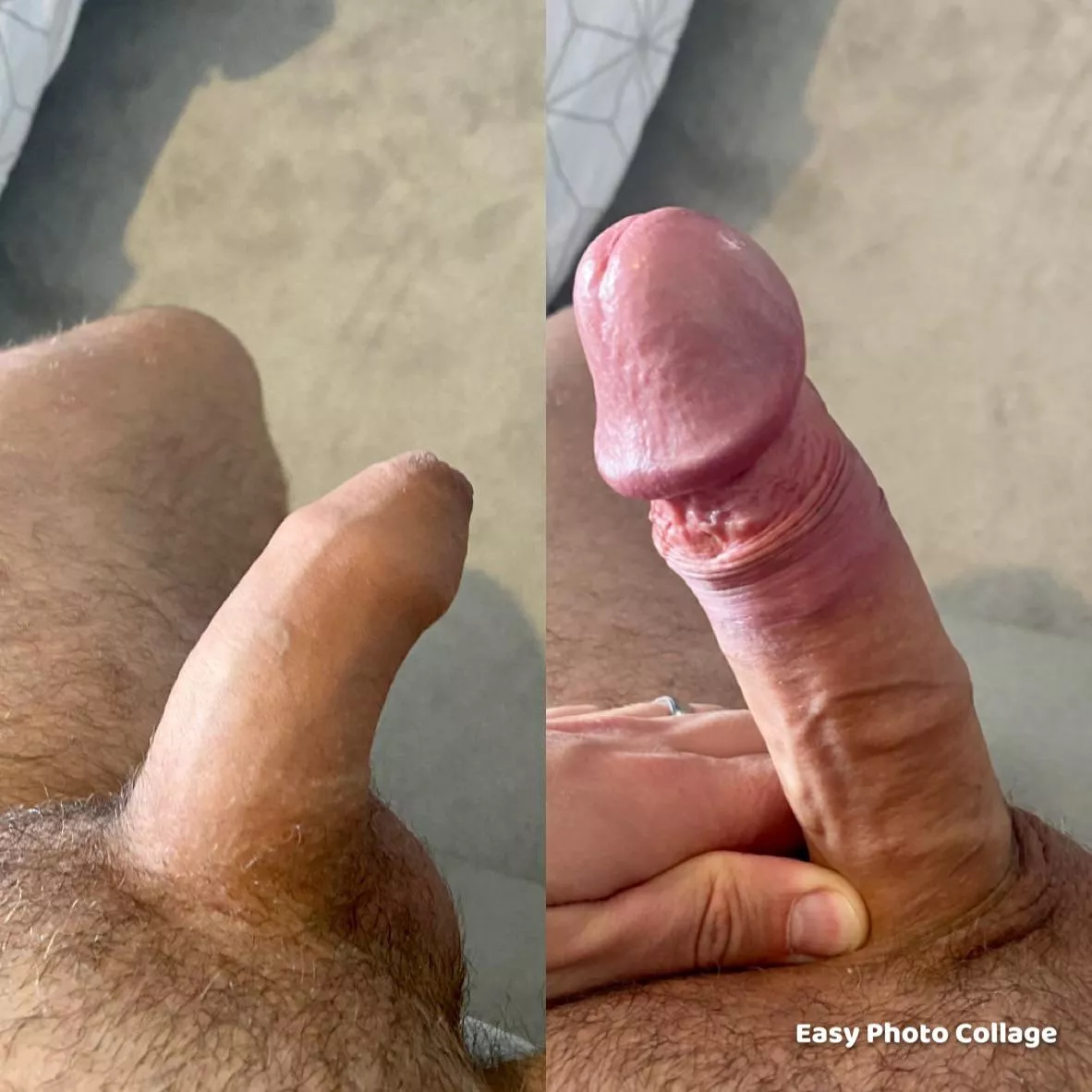 Crazy how my foreskins just slips down completely when I’m this hard. posted by showergreener
