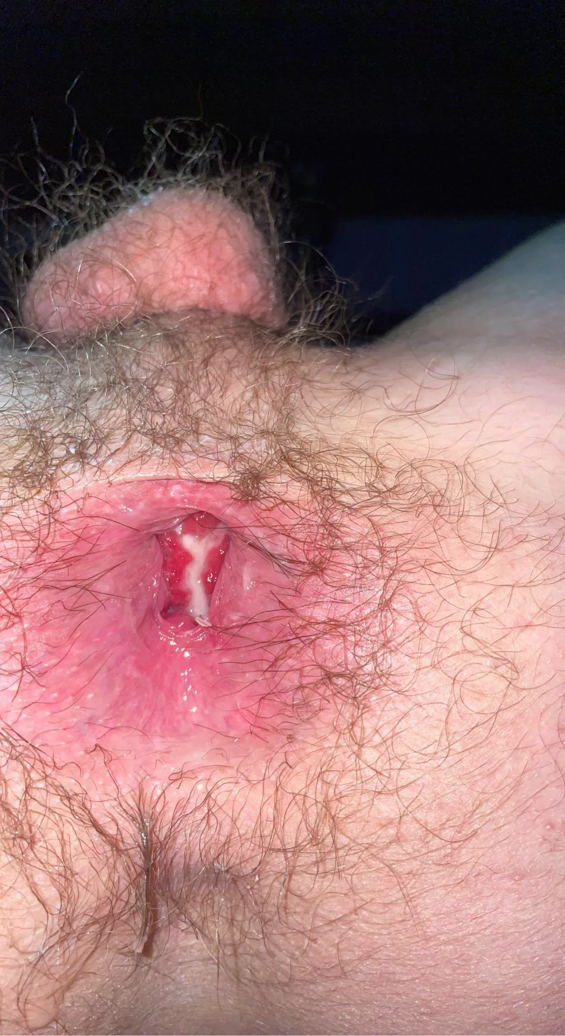 Daddy went really rough on me today but I’m starting to love the feeling of him and his cum inside me🥰 posted by [deleted]