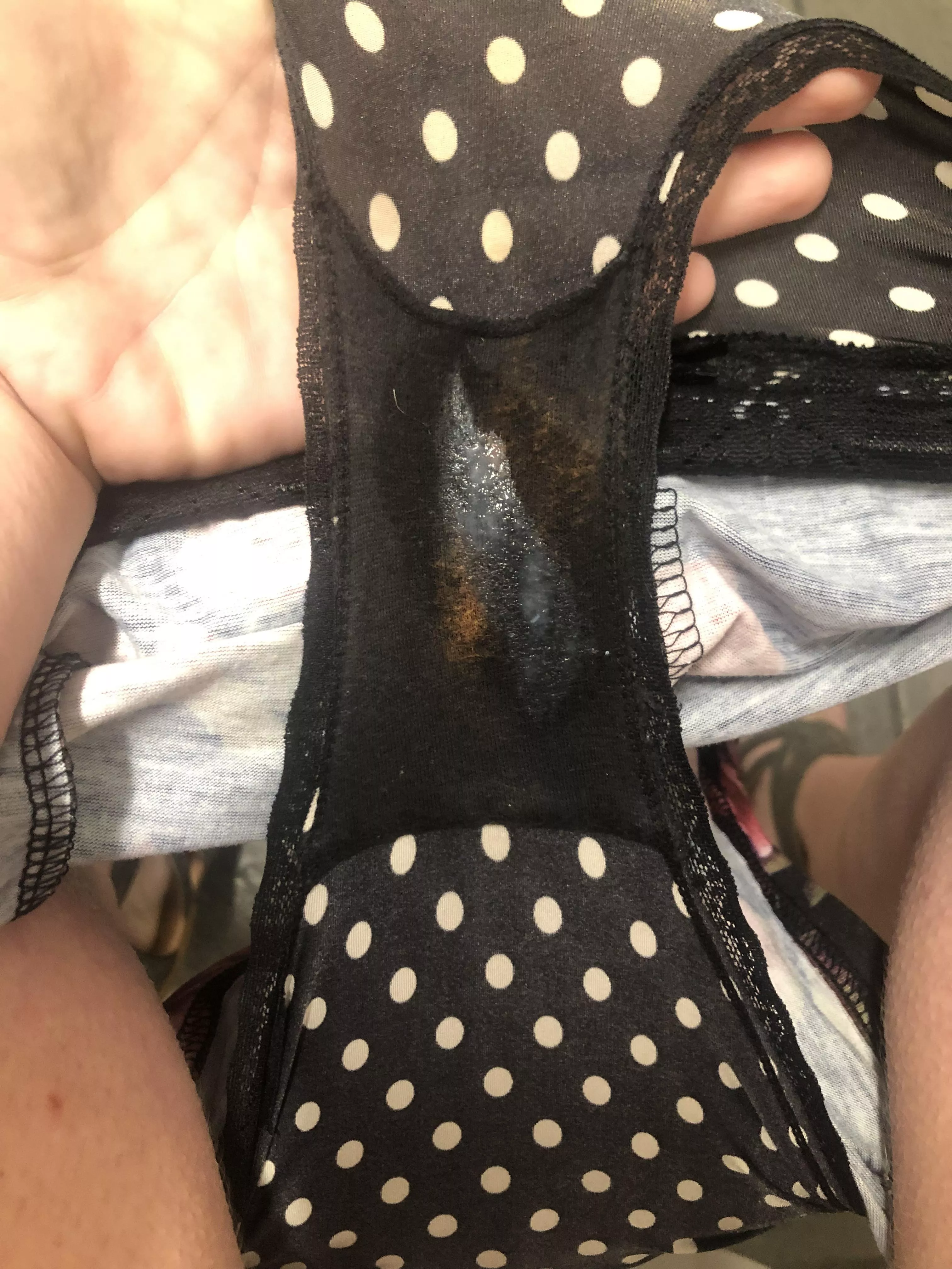 Day one with some prior discoloration due to ph posted by pinkyto04