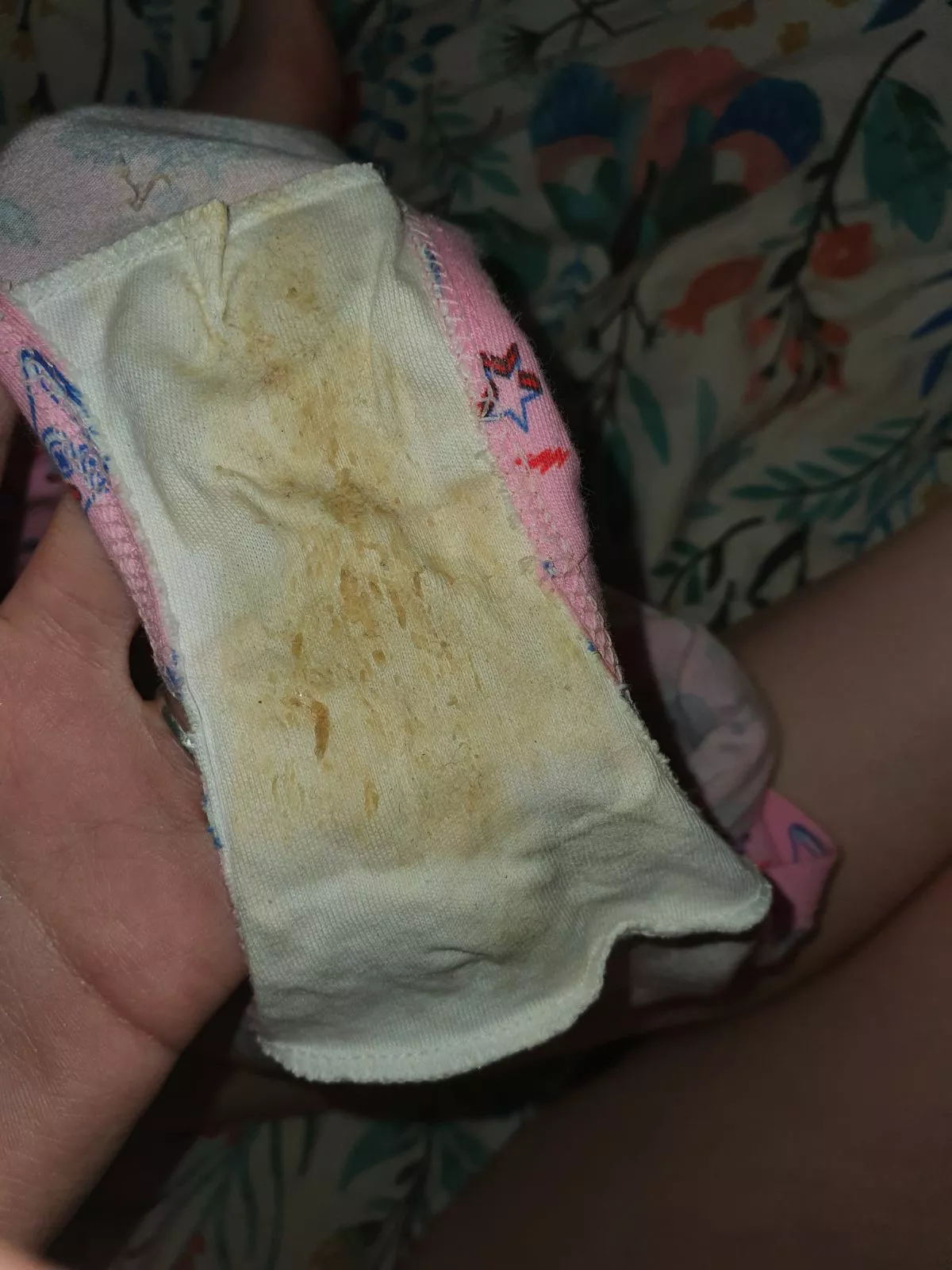 Delicious pair by a lovely hairy redhead girl posted by nightshard30X