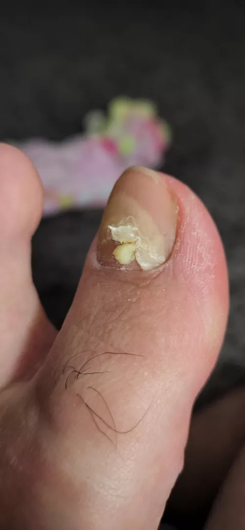 Did not expect this to squeeze out by 808Dredd