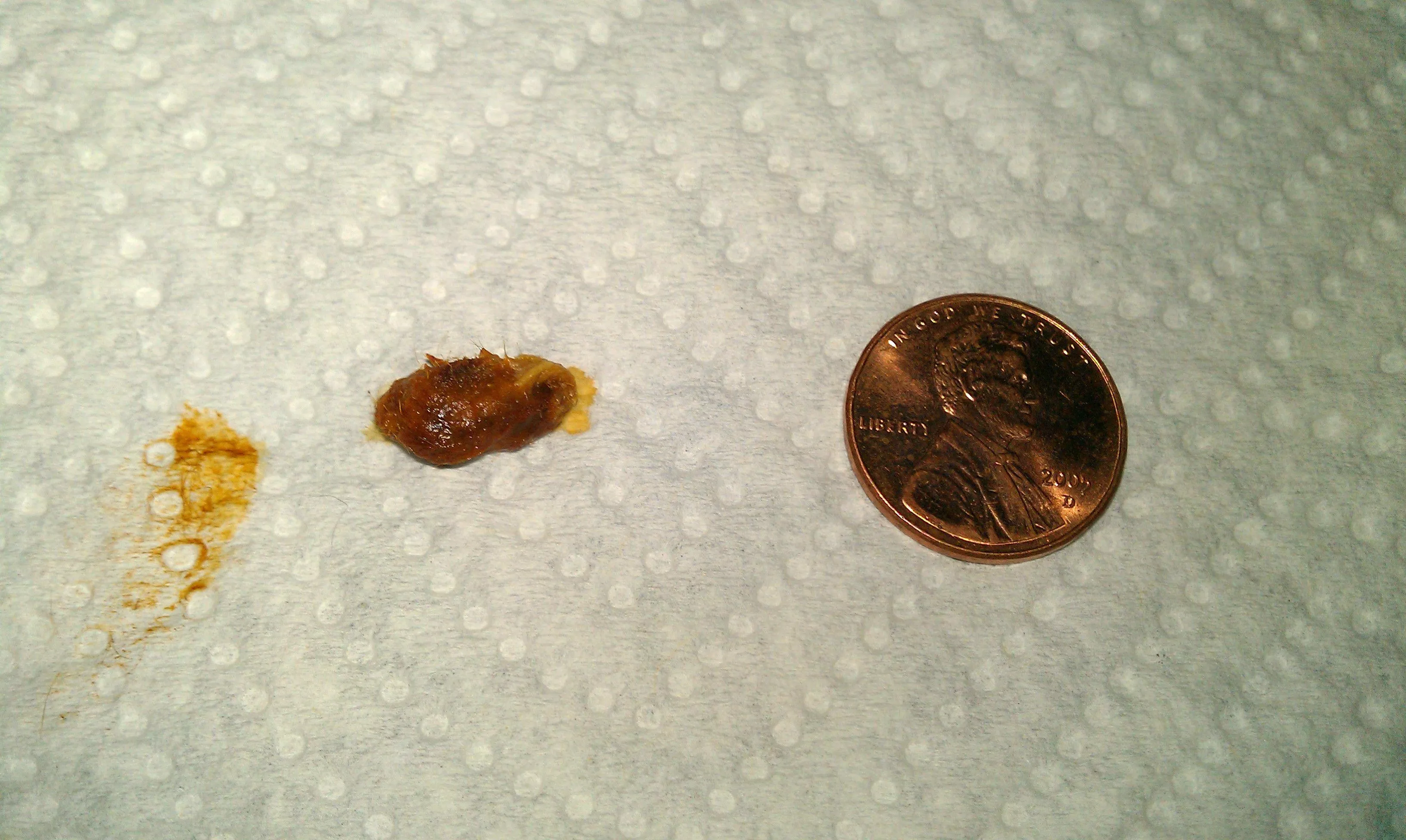 DIY Ear Wax Extraction posted by LokiNightmare