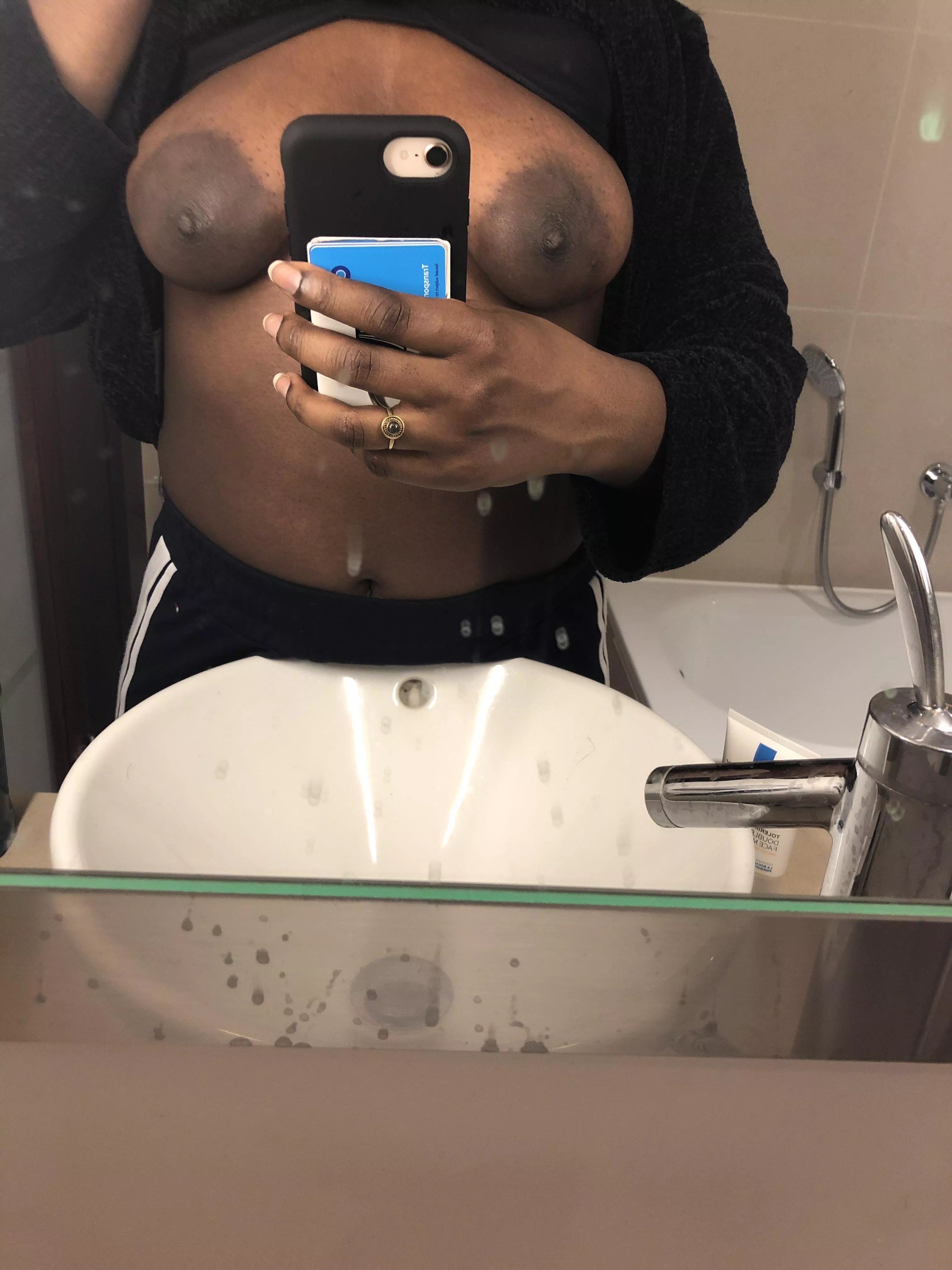 do big areoals belong ehre too? ;) posted by rowdeputy