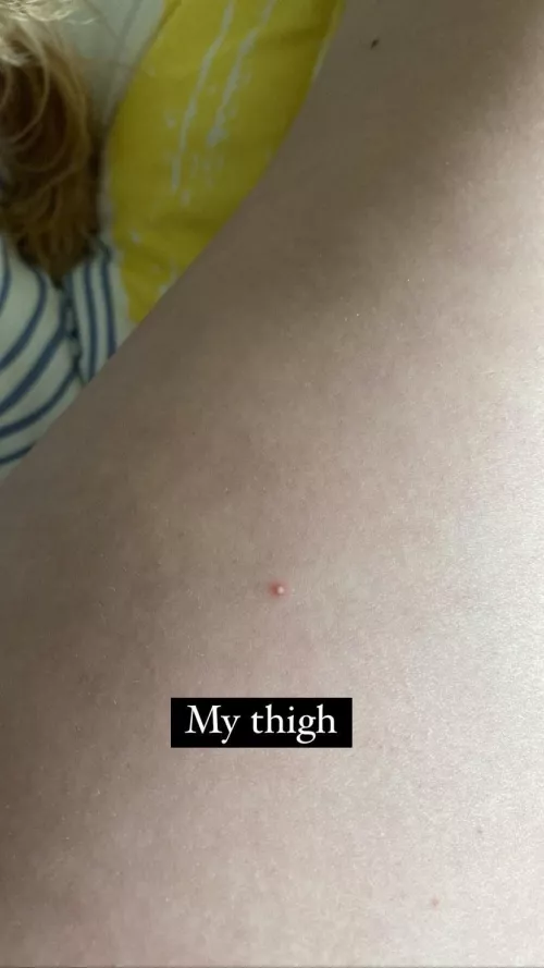 Do I pop it or leave it? by galaxyanimalloverr