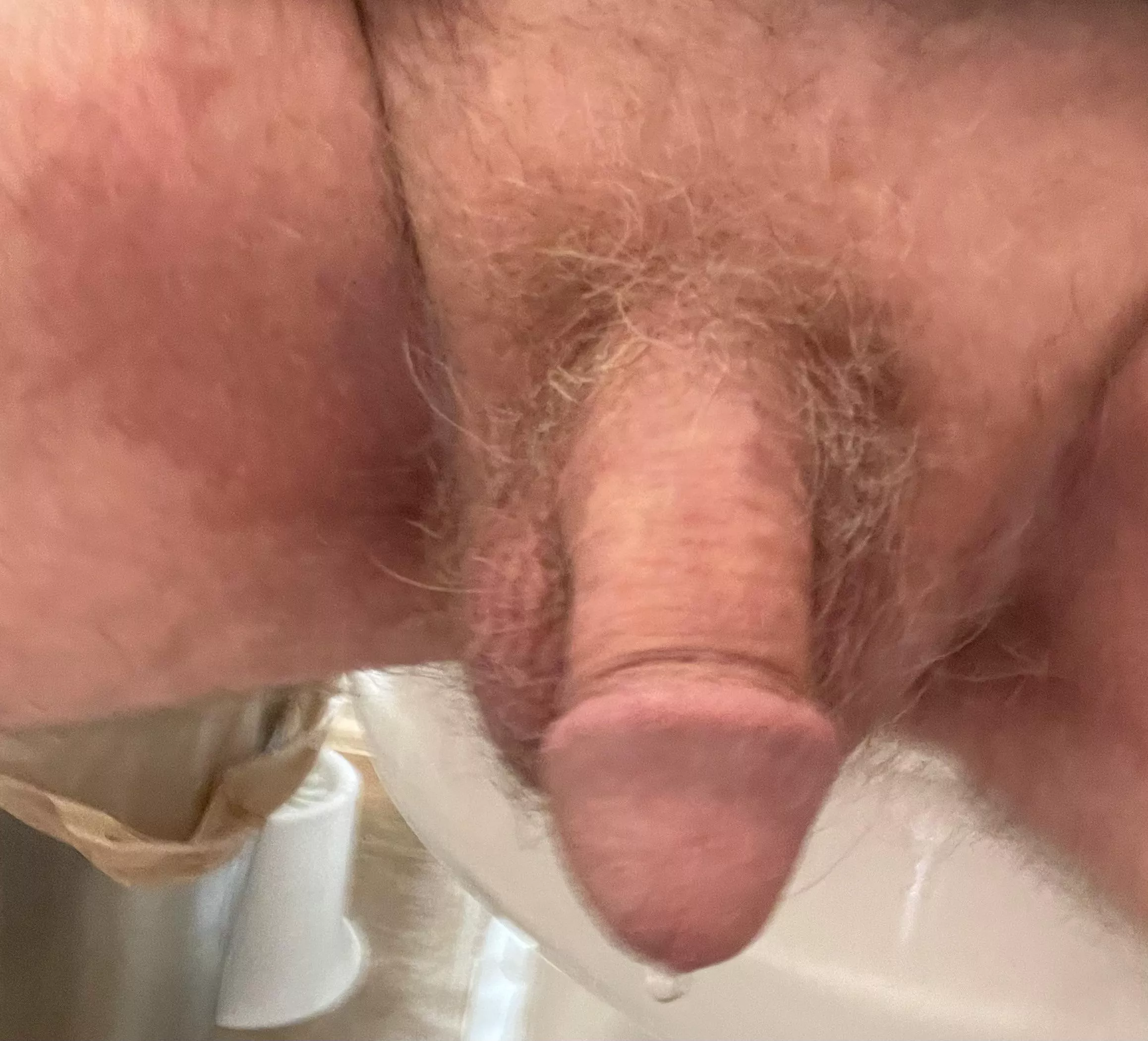 Do I qualify! [77] posted by Super_Appearance7541