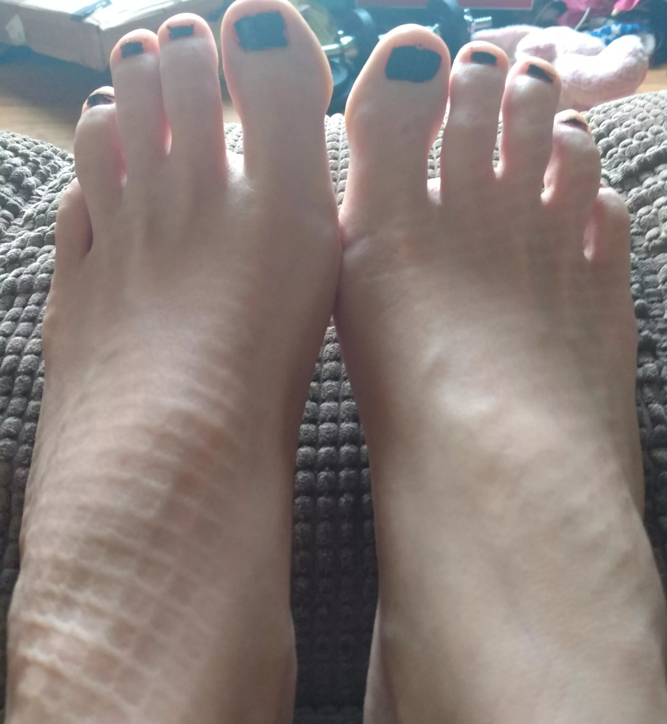 do u like my feet posted by No-Pineapple1481