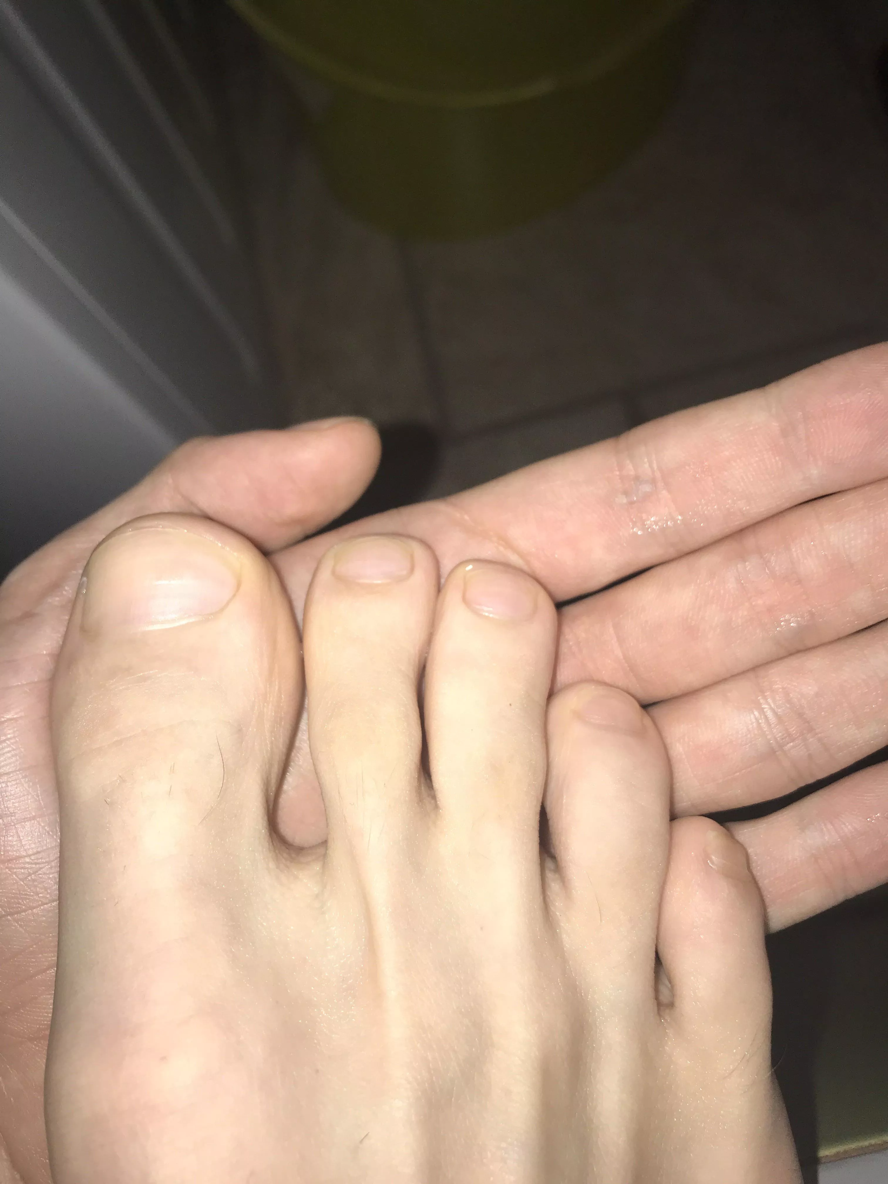 Do you like my toes? posted by onlycreek