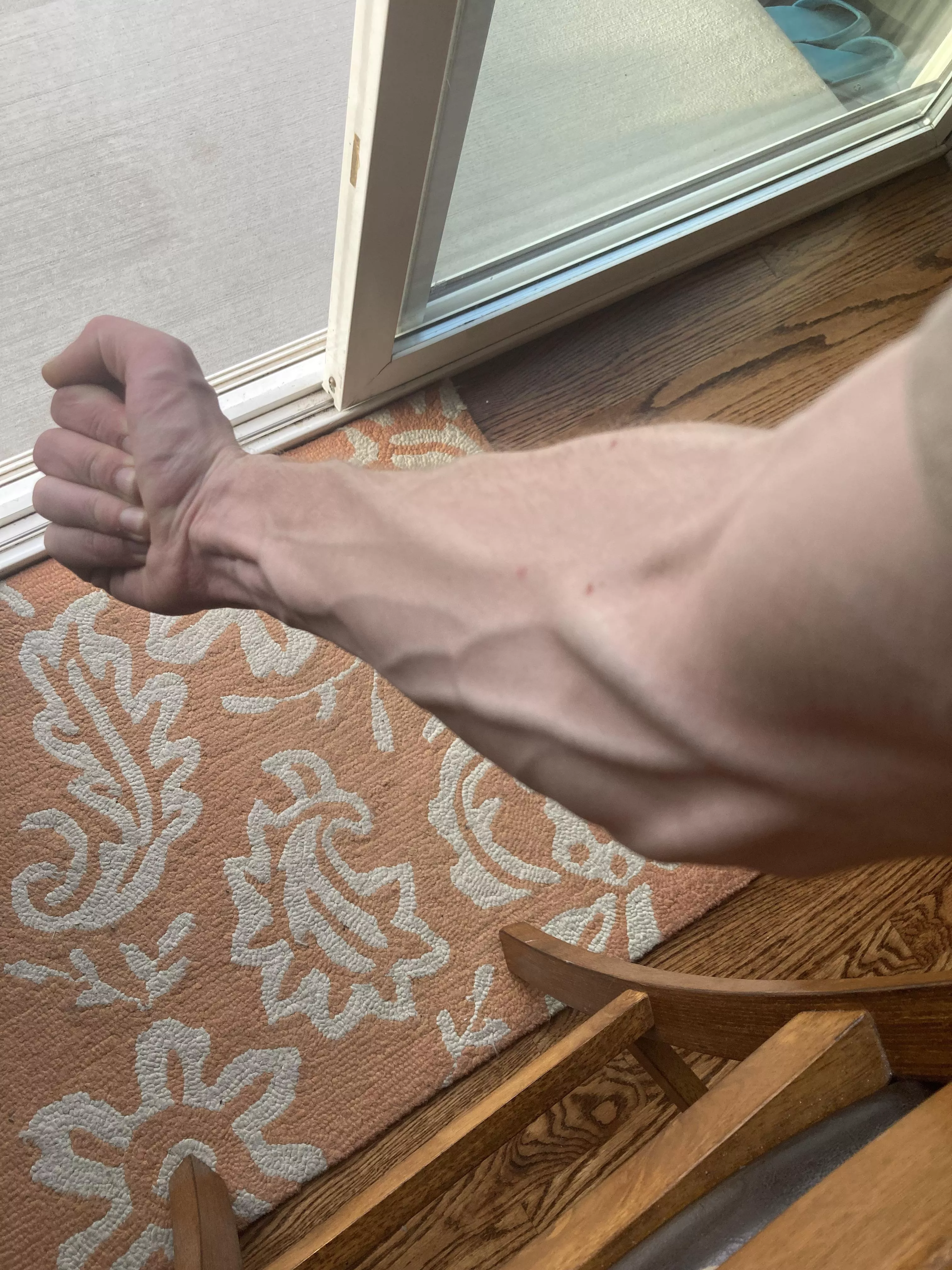 Do you like veins? posted by annnnnnonnn