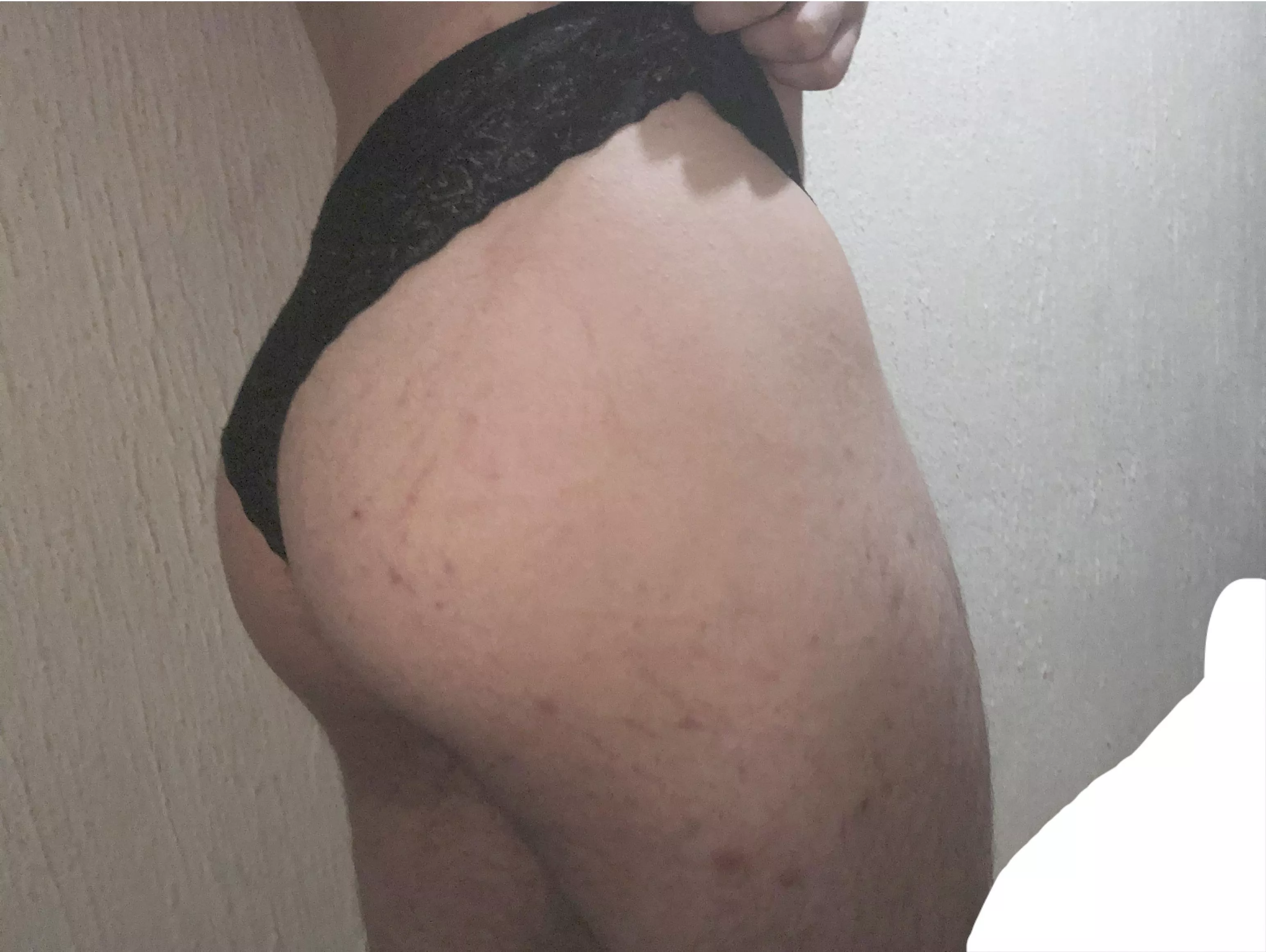 Do you think I look good in these panties?🔥 posted by Chemical_Guess8235