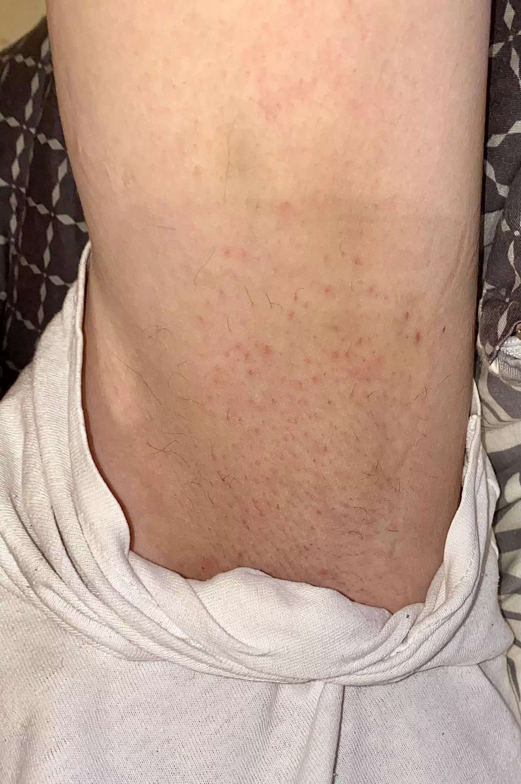 Do you want to check how I smell? 😛 posted by sunnypits