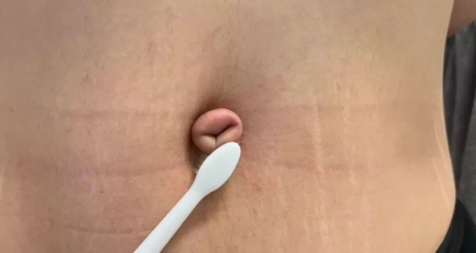 Electric toothbrush on my tied outie by BUBBLEGUMBIITCH