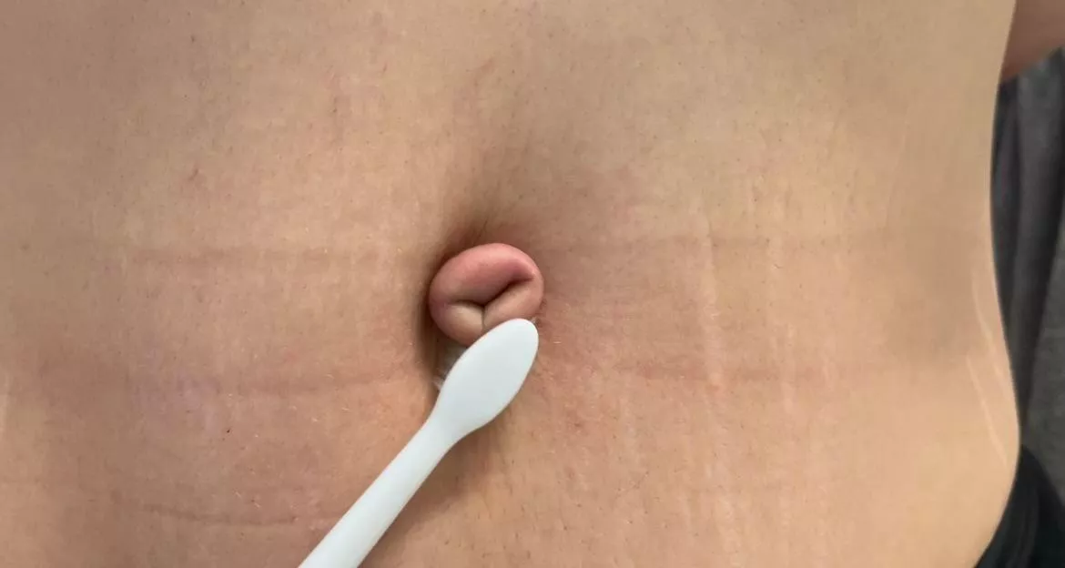 Electric toothbrush on my tied outie posted by BUBBLEGUMBIITCH