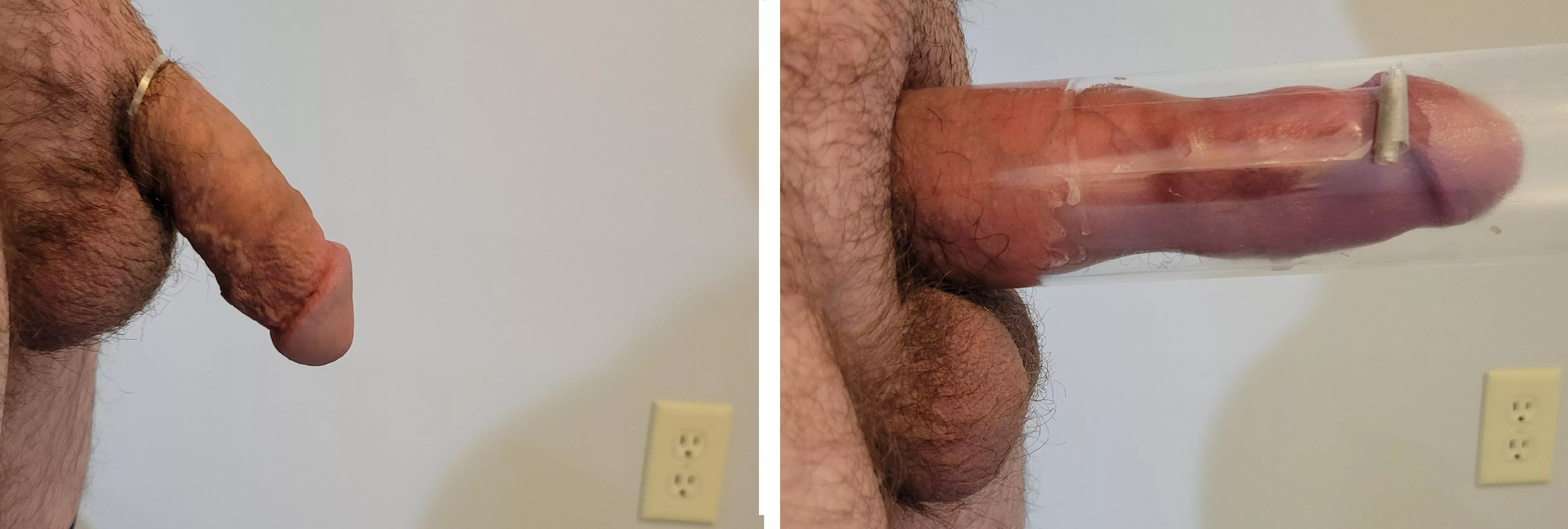 enhanced posted by bittbigger