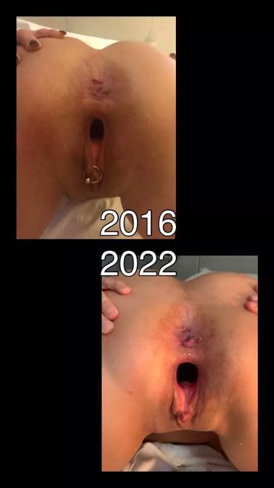 Enlarging my gape posted by Gapingsandra