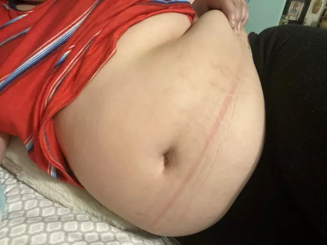 even my legging are starting to leave marks 😅 by tapiocalee