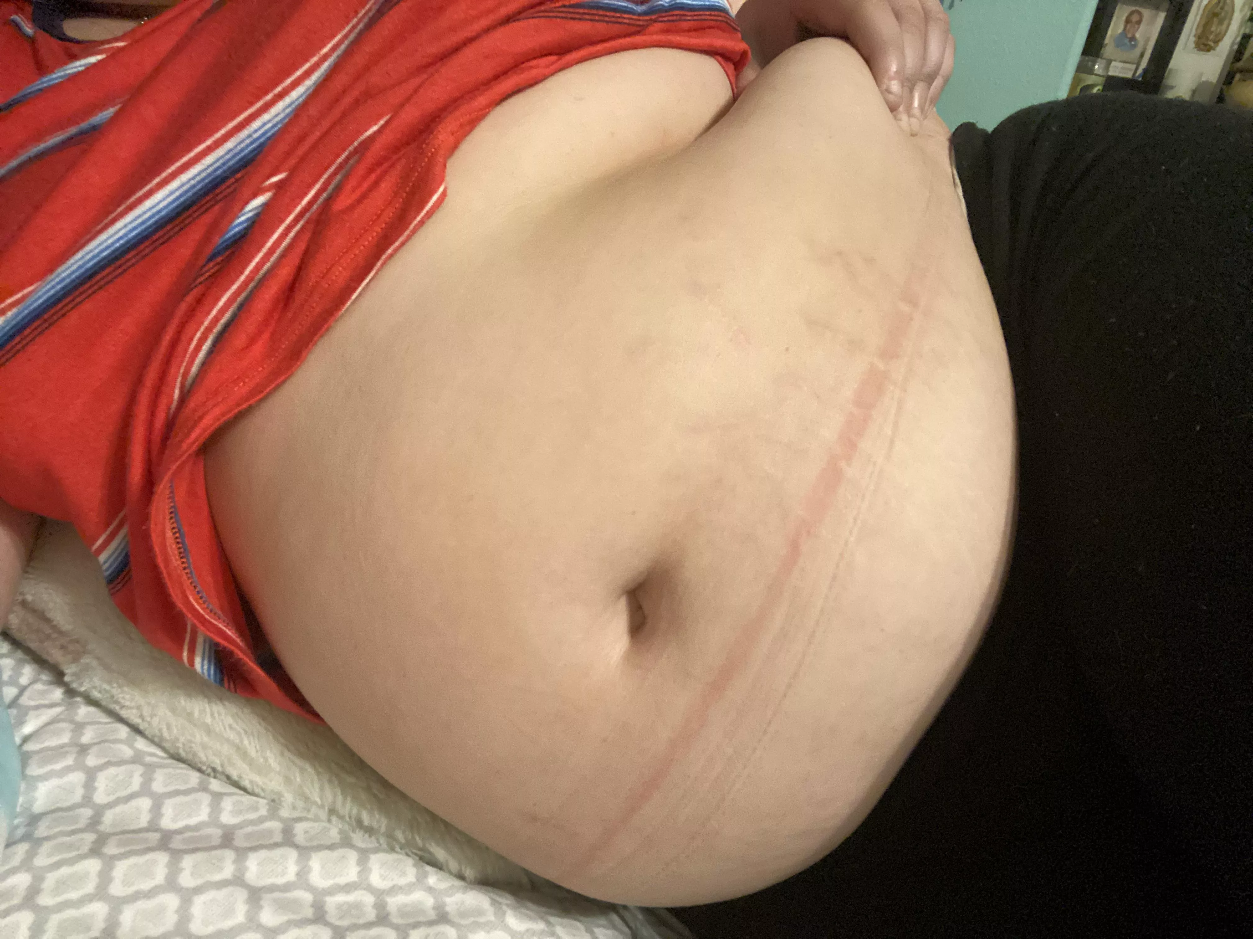 even my legging are starting to leave marks 😅 posted by tapiocalee