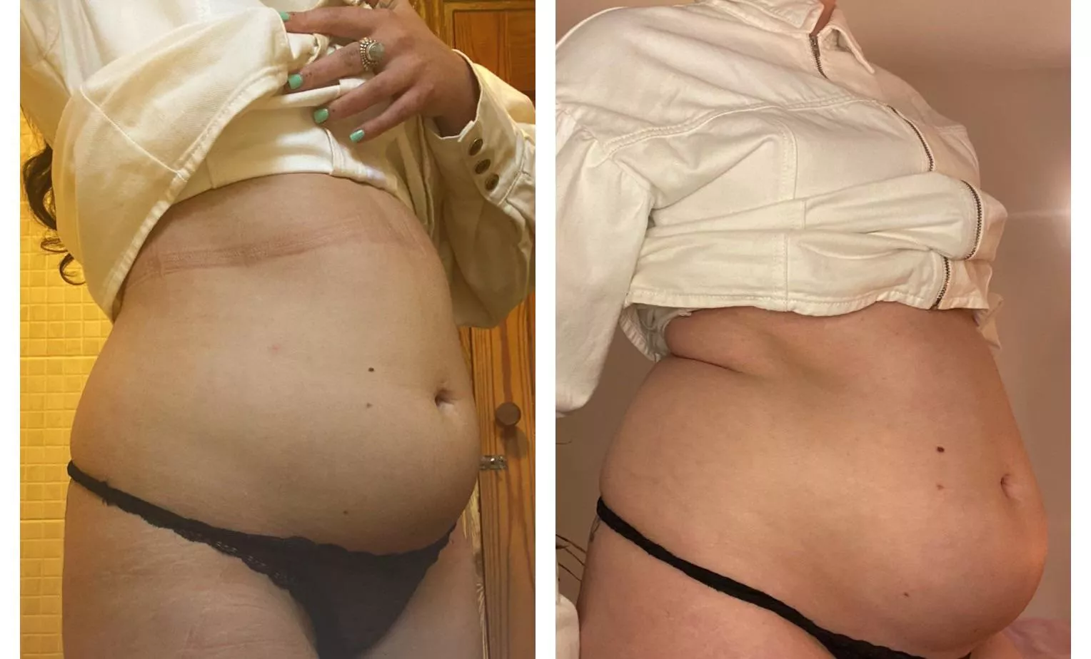 Exactly 1 year later and this dress definitely doesn’t fit the same 😳 posted by squishy_bae