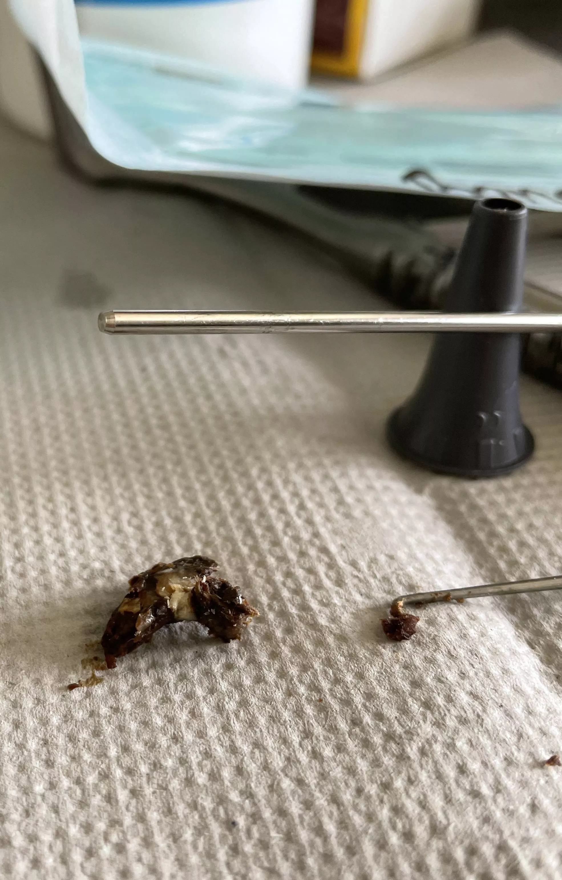 Extracted at the hospital. Now I can hear again. posted by LaBombonera