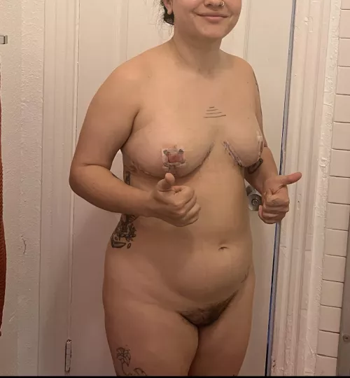 f, 26yo, 152 lbs, 5’0”. 2 days after breast reduction surgery. it hurt too much to relax my shoulders back, stand up straight, do all the things I do to feel attractive and comfortable. and yet, I felt SO much more like myself, like I had the body I  by cottontailmoon