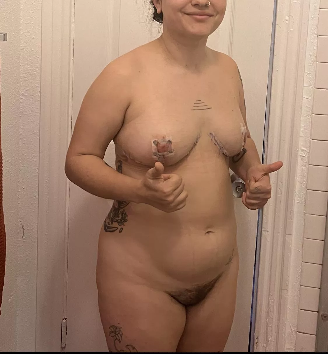 f, 26yo, 152 lbs, 5’0”. 2 days after breast reduction surgery. it hurt too much to relax my shoulders back, stand up straight, do all the things I do to feel attractive and comfortable. and yet, I felt SO much more like myself, like I had the body I  posted by cottontailmoon