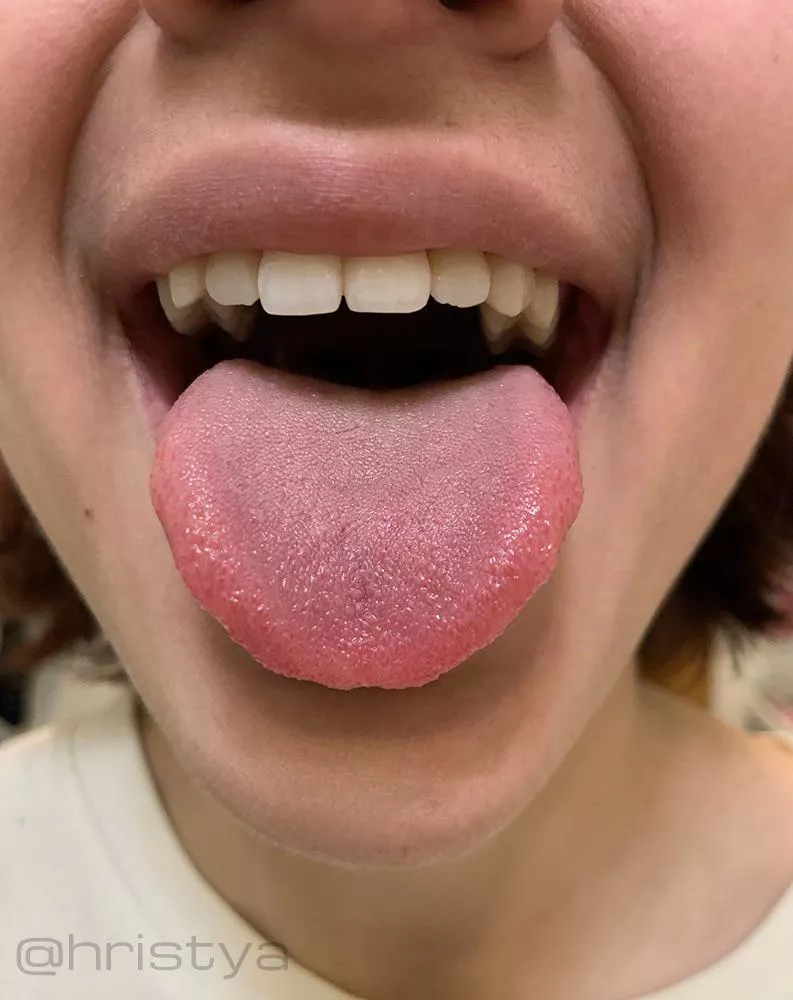 f19. rate my tongue please. posted by bearded_hands
