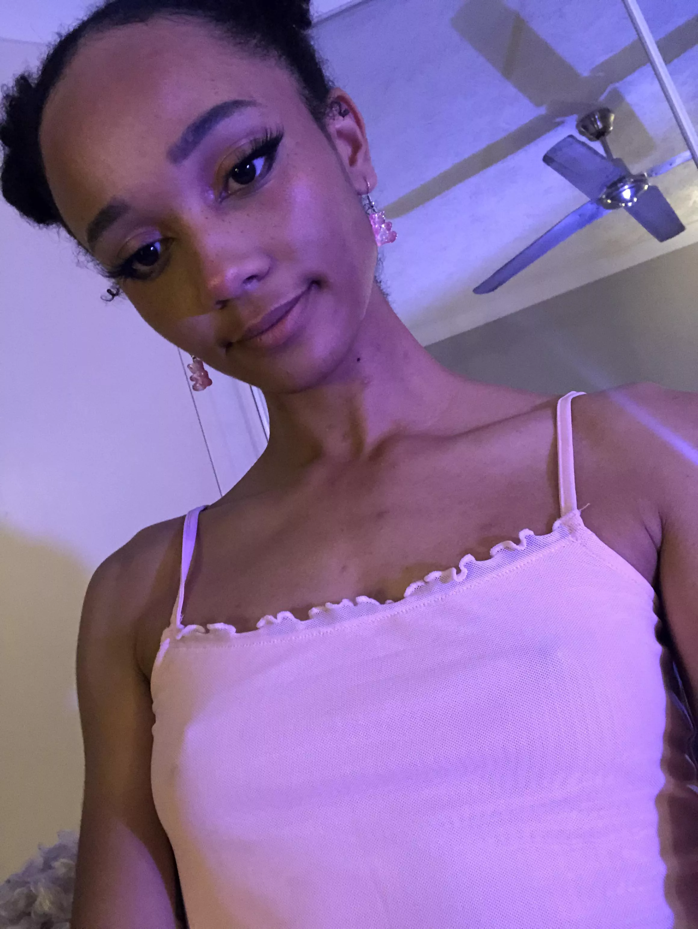 (F21) Mosquito bites 😭😳 posted by catzcereal