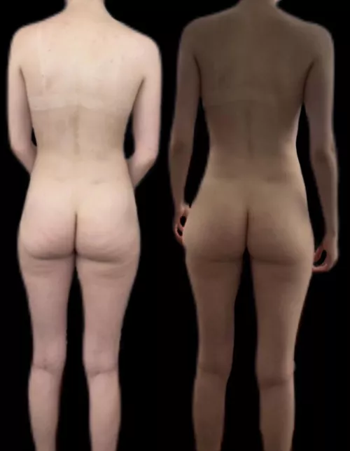 F23/5’9/138 - direct light standing naturally vs indirect light w/ slight pelvic tilt, feet farther apart & shoulders back by normal_person365
