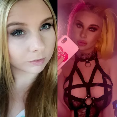 February 4hh cannot come any quicker. Getting more fillers and new XL implants. I CANNOT WAIT! by socketelephant