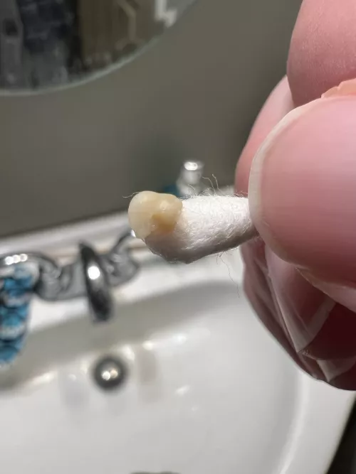 Felt a tickle in the back of my throat. Poked around a little and got this sucker out. by Pina_Coladaburg