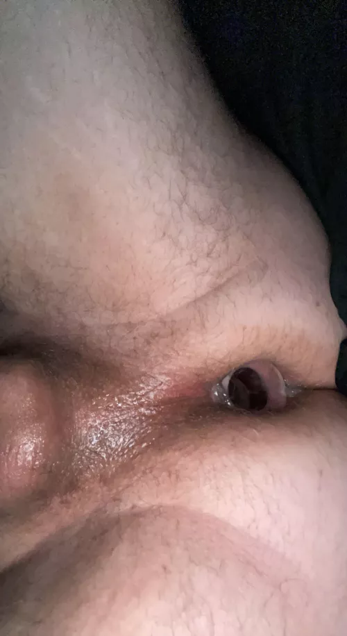 Filled and plugged by w2urmf