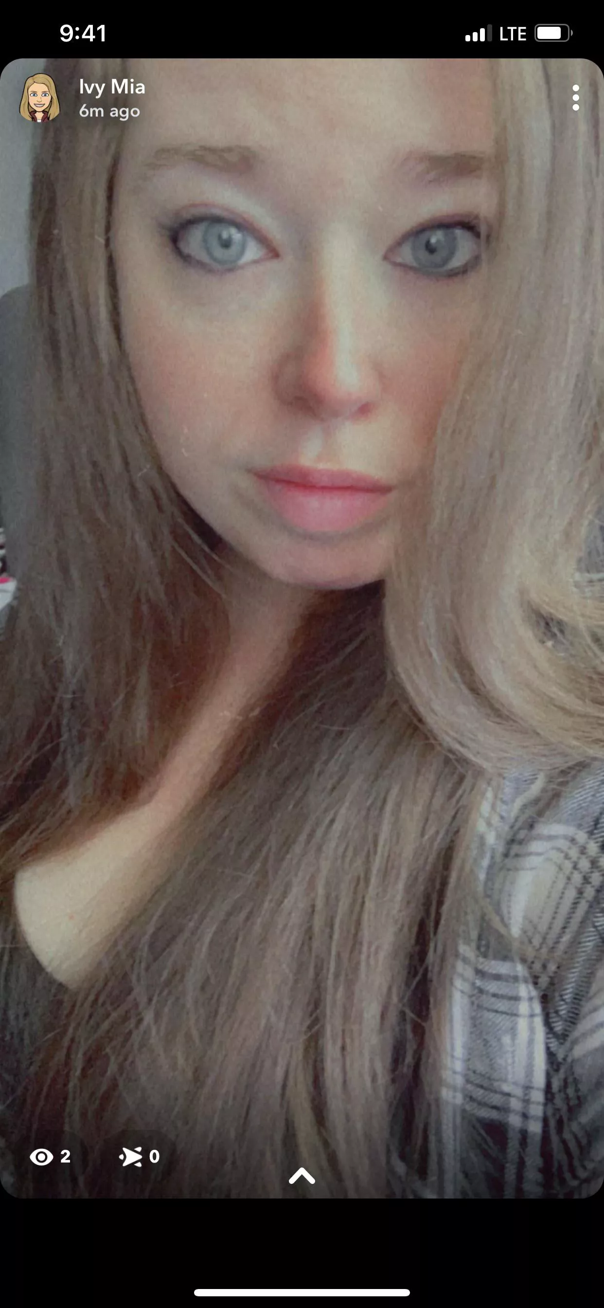 Filters aren’t always freckle friendly 😘 posted by ivymiaexplicit