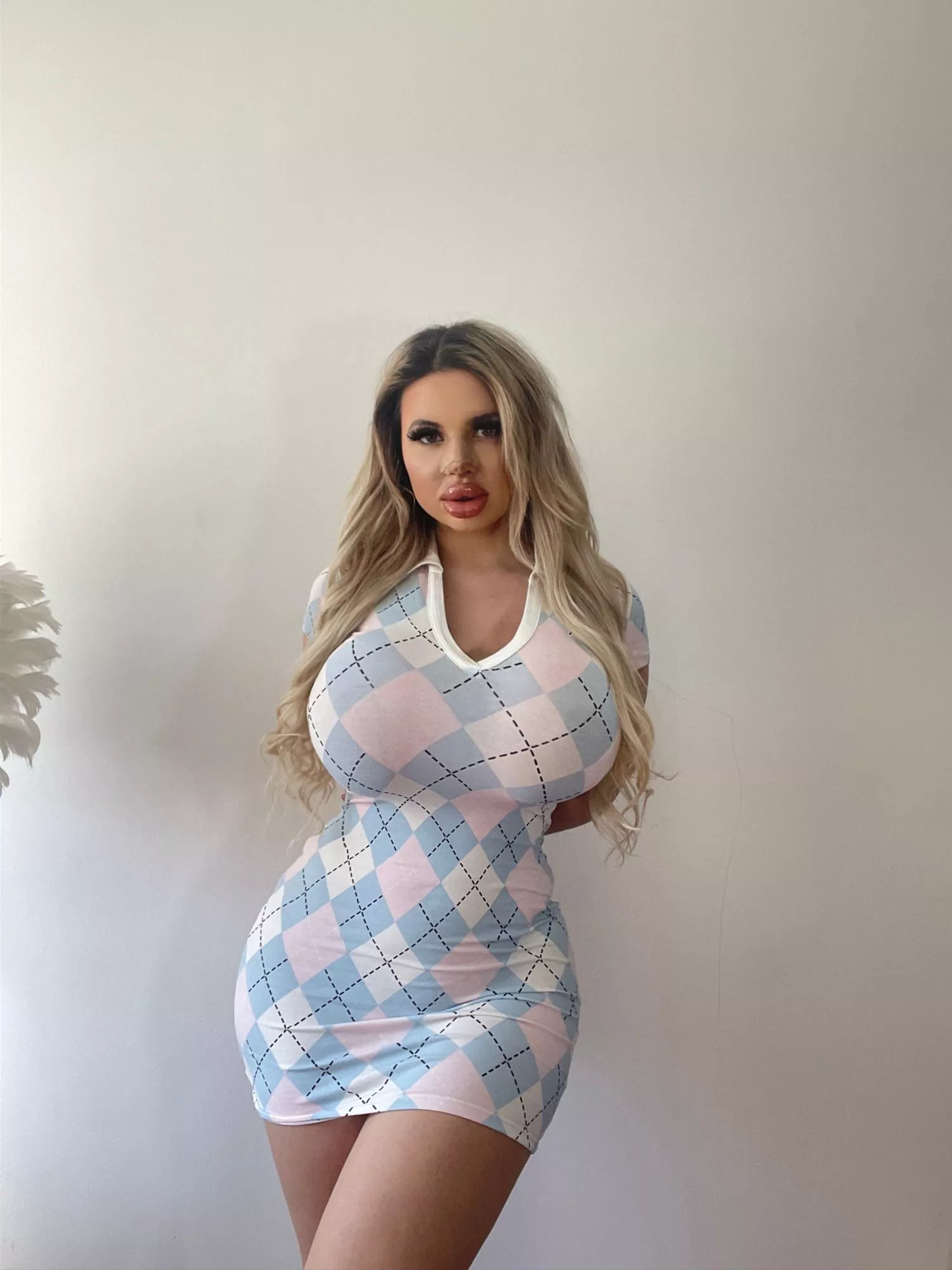 Finally got my nose done! posted by Relevant-Party1420