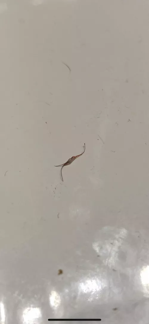 Finally got this thing out of my body after a month of squeezing and poking by wtfisthisgoingonhere