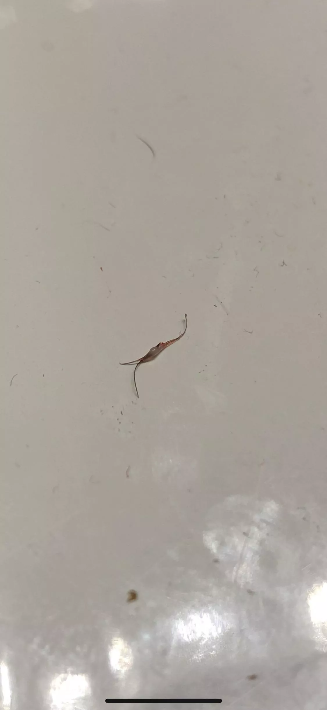 Finally got this thing out of my body after a month of squeezing and poking posted by wtfisthisgoingonhere