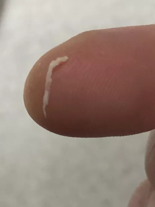 First post :) clogged pore by sashy311