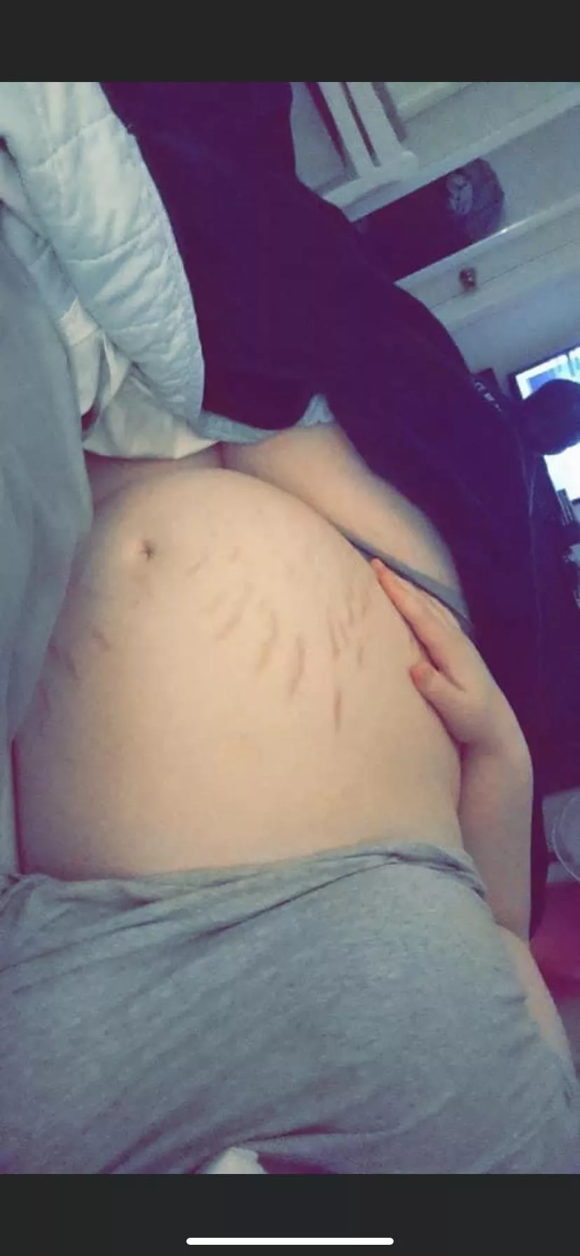First real belly pic, do you guys like my stretch marks? posted by According-Try-8005